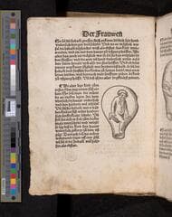 Go to image 34.