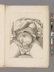 Go to image 19.